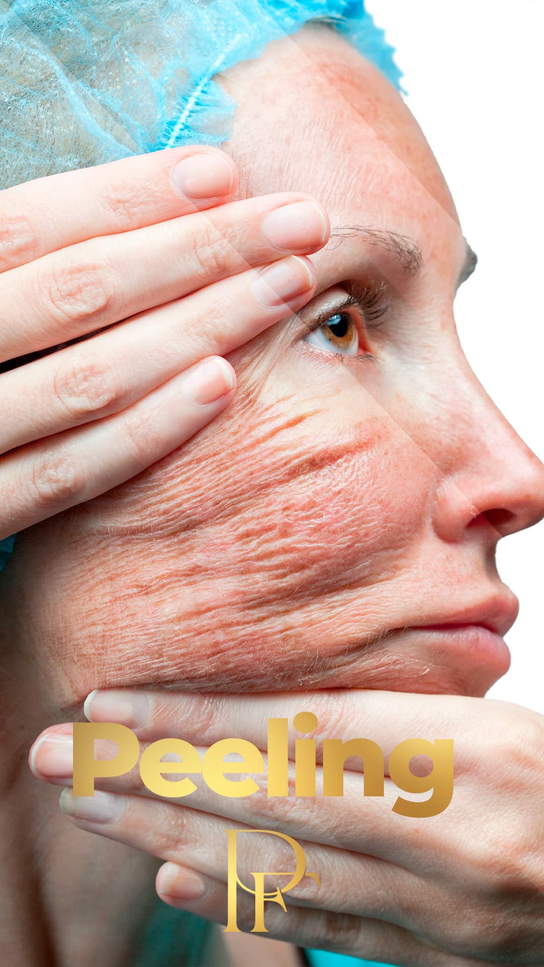 Skin Line